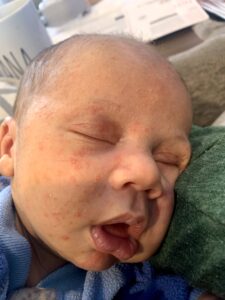 Open mouthed baby noting tongue and lip tie concerns