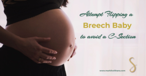 attempt flipping a breech baby and avoid a c-section